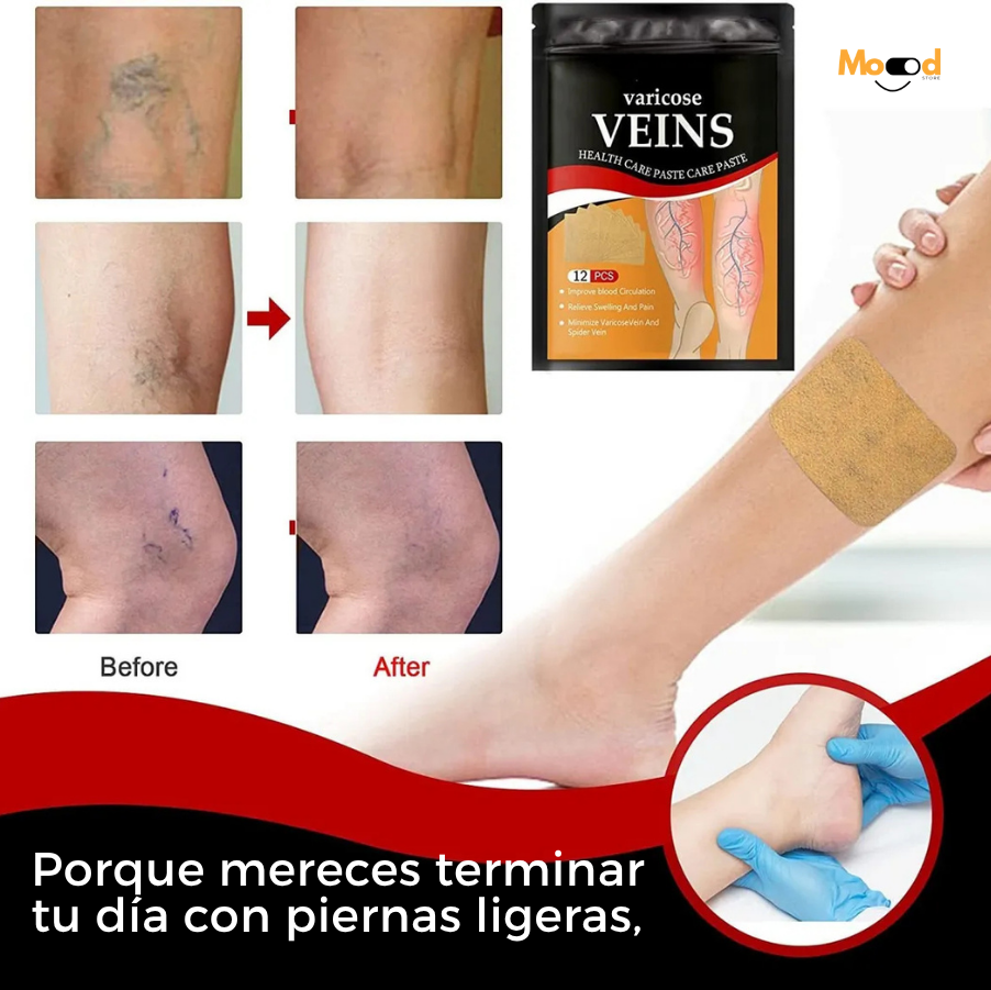 Parches Tratamiento de Varices VeinsPatch™ 2x1