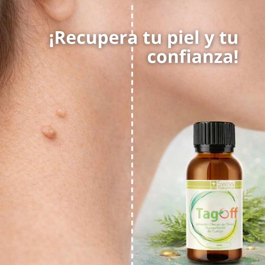 Tag Off™ Solución Verrugas y Carnosidades – Eliminador Cutáneo