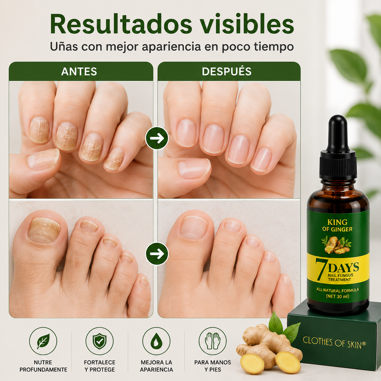 Suero Reparador Antifúngico de Uñas PureNails™ – Nutre y Protege – Recupera el aspecto saludable de tus uñas progresivamente