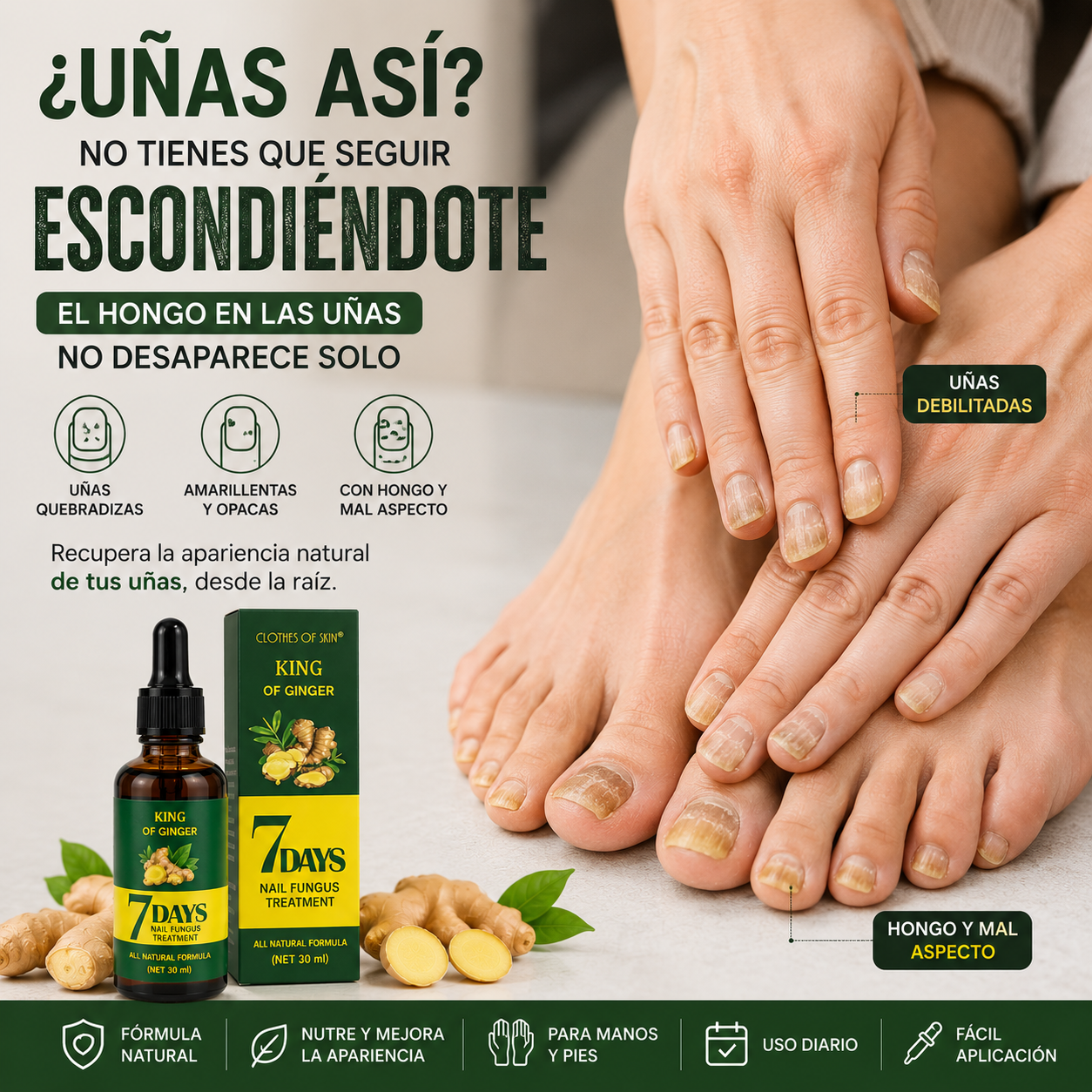 Suero Reparador Antifúngico de Uñas PureNails™ – Nutre y Protege – Recupera el aspecto saludable de tus uñas progresivamente